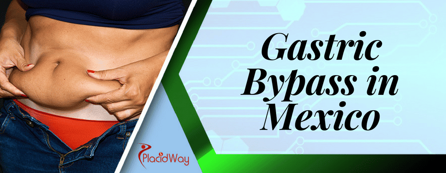 Gastric Bypass in Mexico